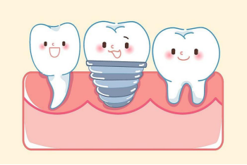【健康科普】你适合做种植牙吗？