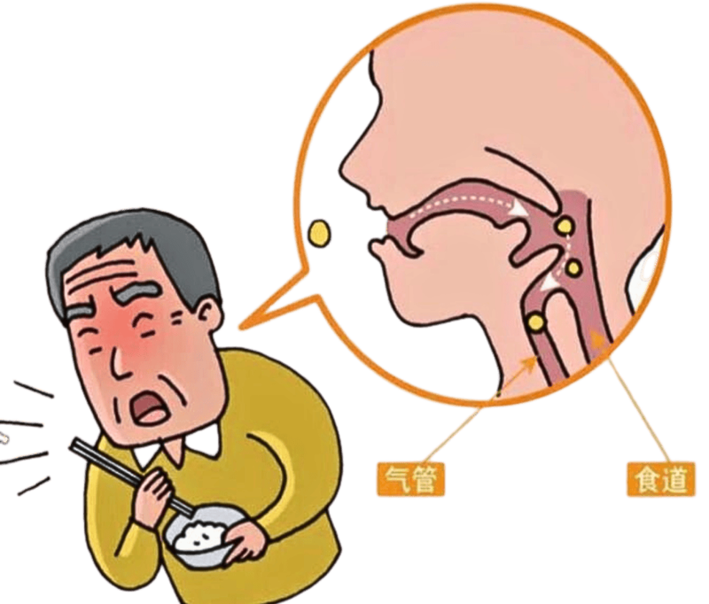 【健康科普】吞咽障碍知多少？一起谈谈这个“舌尖上的危险！”