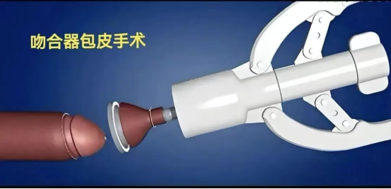 79f15a5548e110bed3a96cfb95f957f6.png