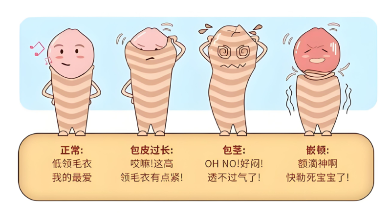【健康科普】包皮过长一定要手术吗？医生说出真相